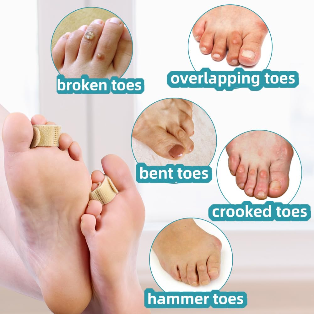 nylon bunion splint C13B being worn inside a shoe